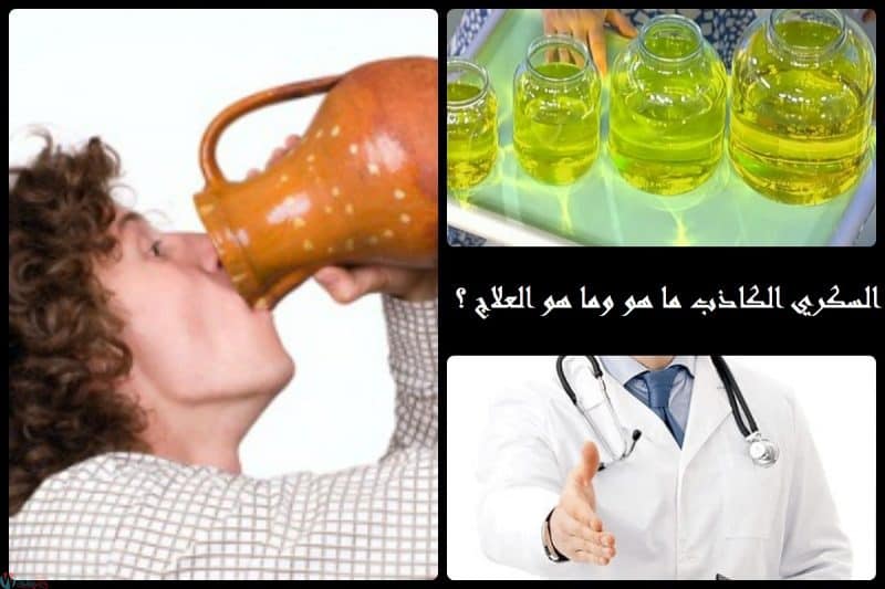 أشمل ملف عربي عن السكري الكاذب من التشخيص وحتي العلاج 1