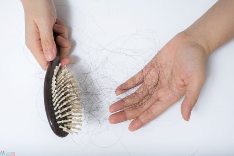 10 طرق لعلاج تساقط الشعر بعد الولادة 7