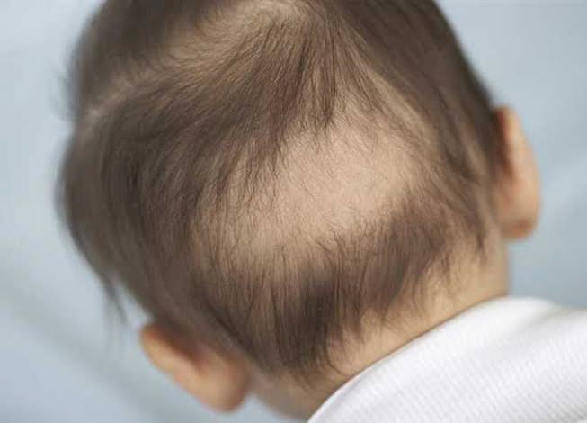 اسباب تساقط الشعر لدى الأطفال? 5